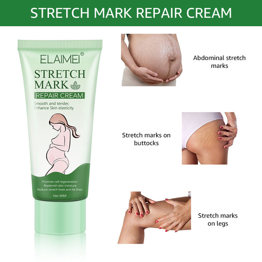Dehnungsstreifen-Creme – Straffend, pflegend & für elastische Haut (60 ml)