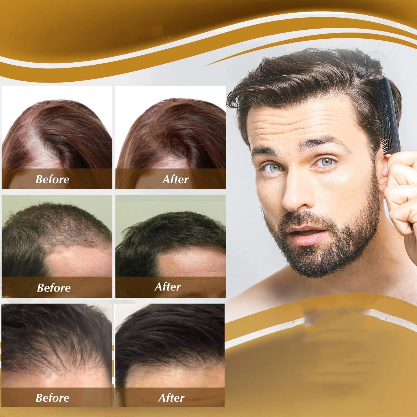 Anti Hair Loss Hair Nourishing Liquid – Haarstärkung, Haarwachstum, Pflege & Festigung