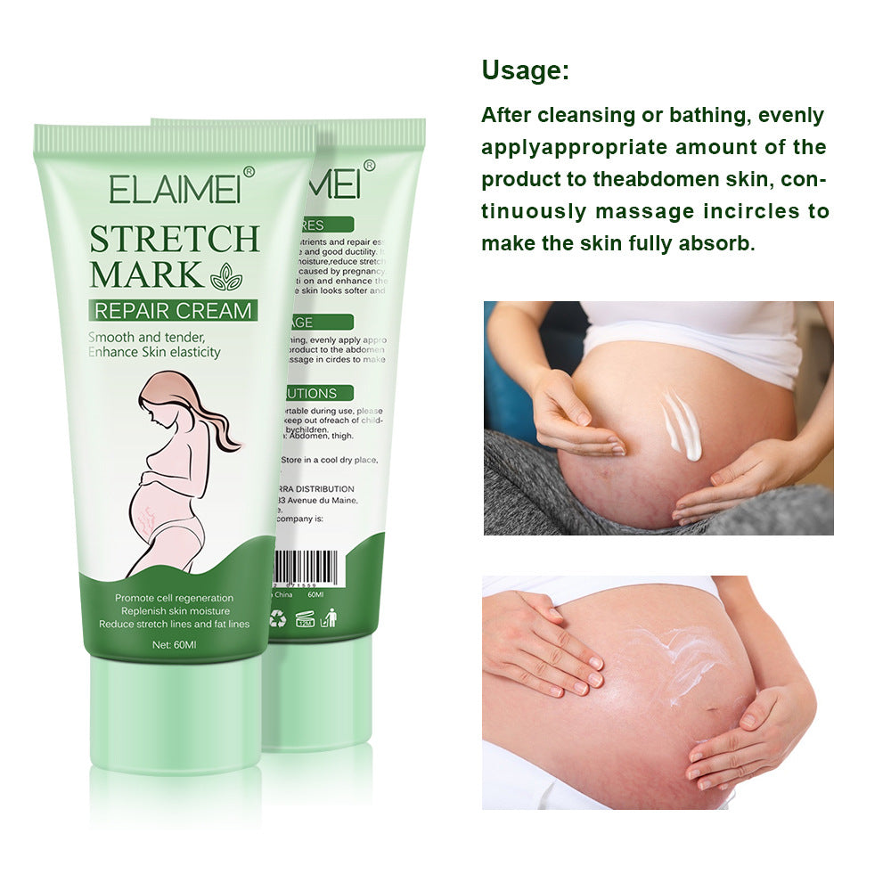 Dehnungsstreifen-Creme – Straffend, pflegend & für elastische Haut (60 ml)