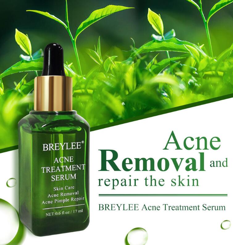 Anti-Akne Gesichtsöl – Repair & Pflege