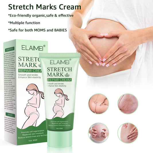 Dehnungsstreifen-Creme – Straffend, pflegend & für elastische Haut (60 ml)