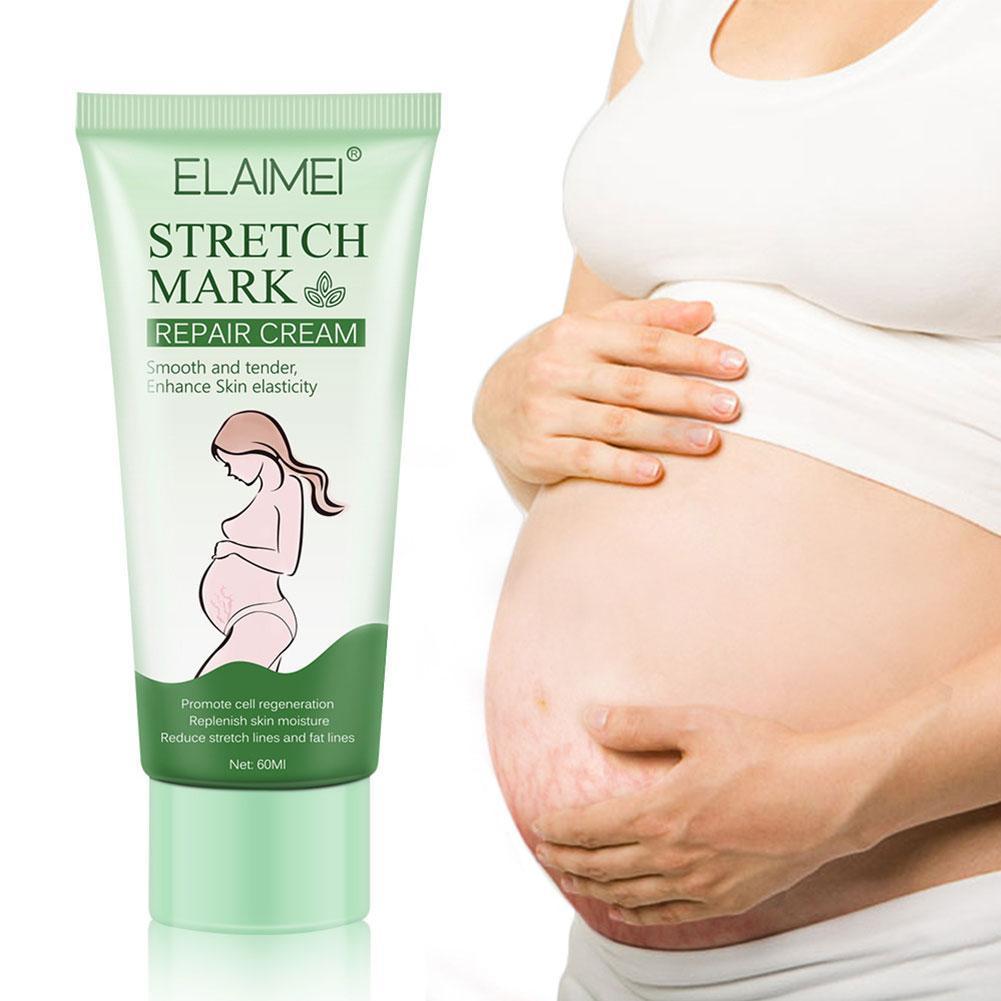 Dehnungsstreifen-Creme – Straffend, pflegend & für elastische Haut (60 ml)