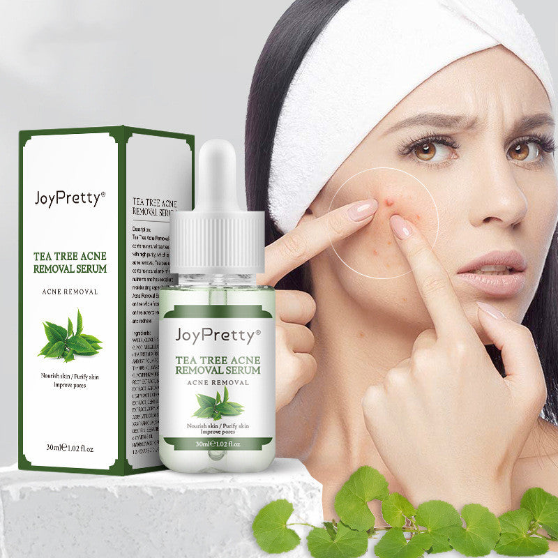Teebaum-Aknecreme – Reduziert Pickel & Akneflecken