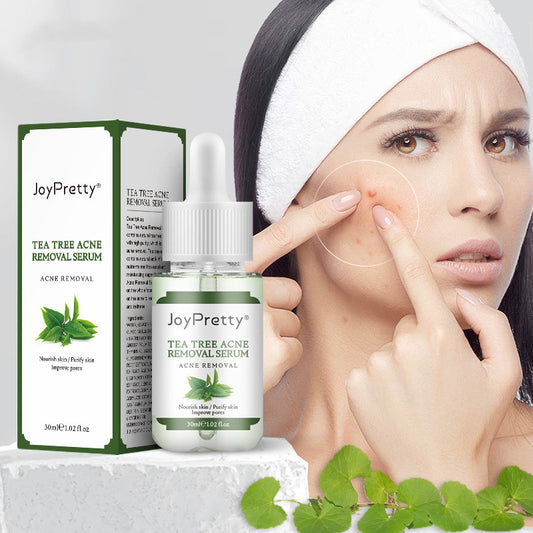 Teebaum-Aknecreme – Reduziert Pickel & Akneflecken